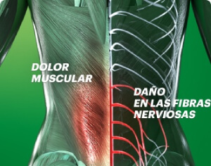 Diferencia entre dolor muscular y daño nervioso Cuerpo humano con detalle de daño en fibras nerviosas