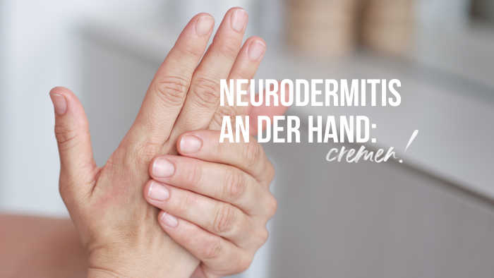Weibliche Neurodermitis-Hände