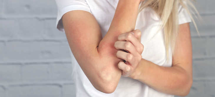 Person hält sich unangenehm juckende Hautpartie z.B. Arm