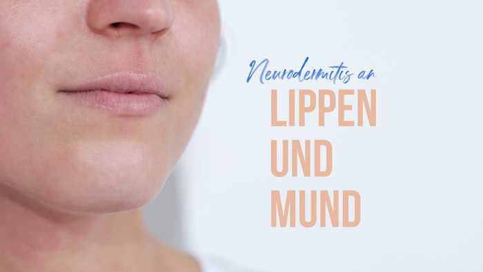 Mund mit Neurodermitis