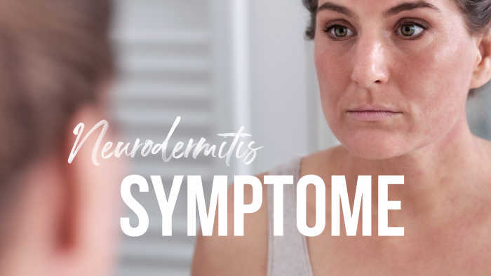 Neurodermitis Symptome