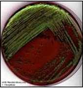 Servizio di Microbiologia Diagnostica di Laboratorio 2