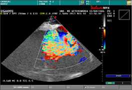 Apparato Cardiocircolatorio CV