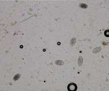 Servizio di Parassitologia Diagnostica di Laboratorio