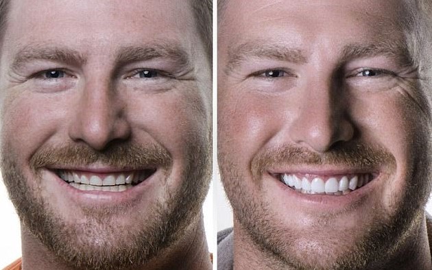 Hollywood smile: Nick Furphy, 31, recently underwent a $25,000 teeth transformation. The former Married At First Sight star is pictured before (L) and after (R) the dental procedure 
