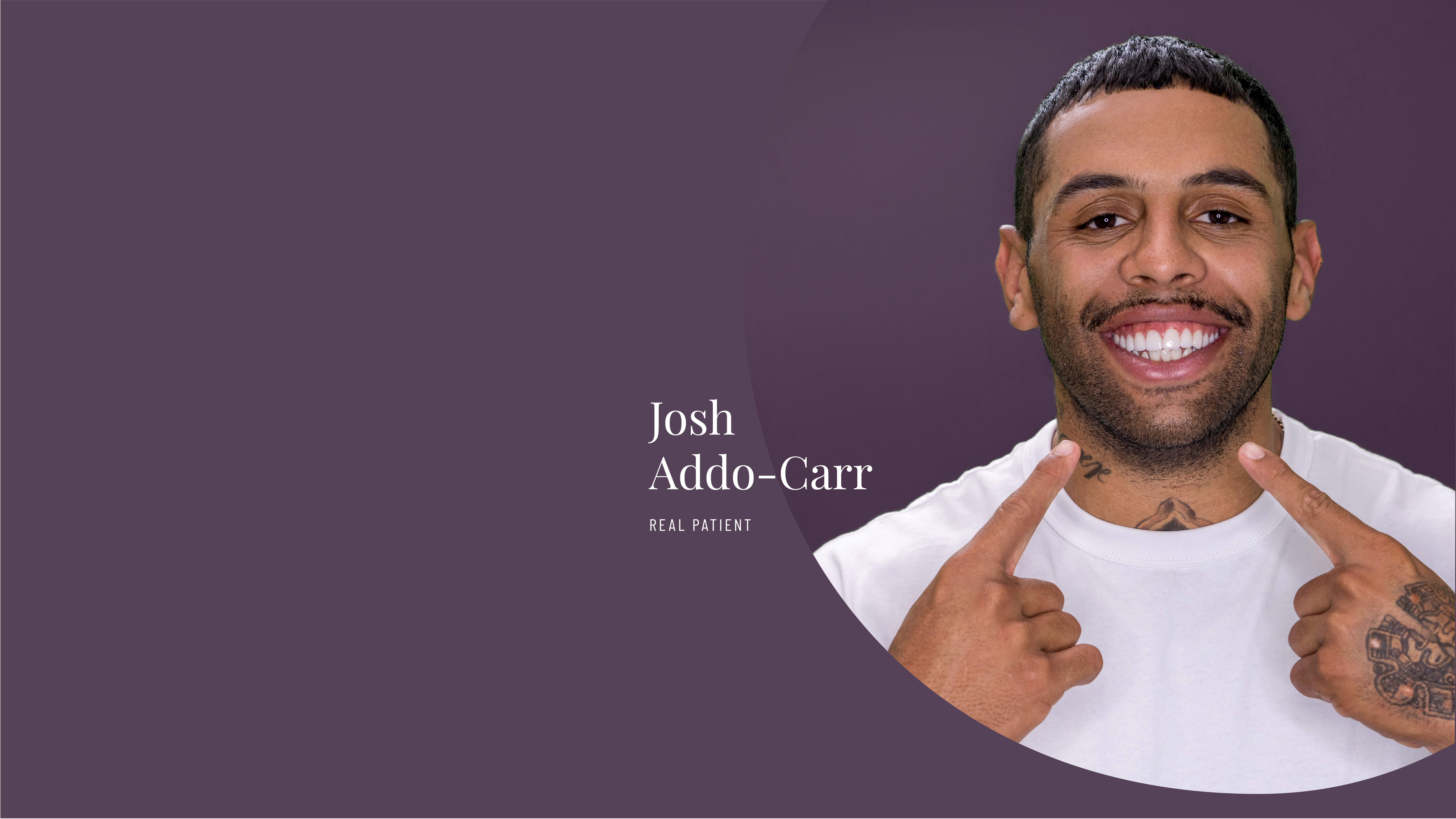 Josh Addo-Carr has regular dental checkups and professional dental cleaning at Vogue Dental Studios.