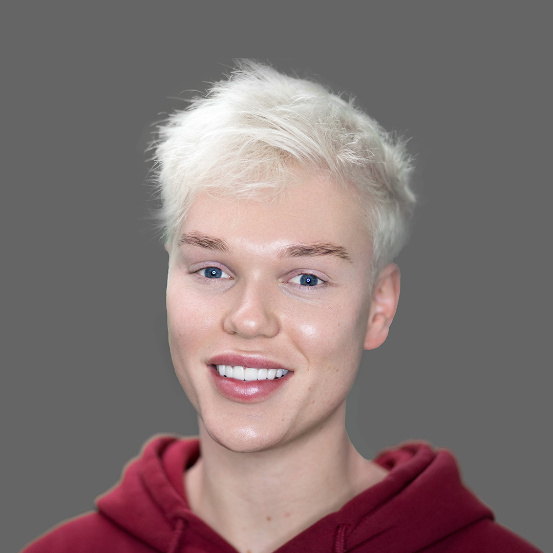Jack Vidgen, from The Voice, with Picasso Porcelain Veneers by Dr Dee at Vogue Dental Studios.