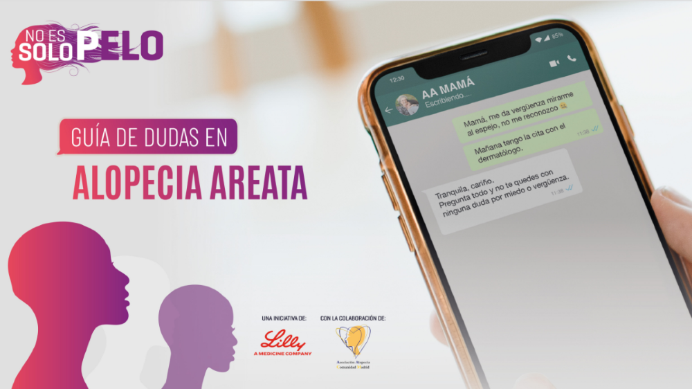 Portada de la guia de dudas en alopecia areata. Aparece un movil con una conversación de whatsapp y dos siluetas de personas sin pelo con el titulo de Guia de Dudas en Alopecia Areata