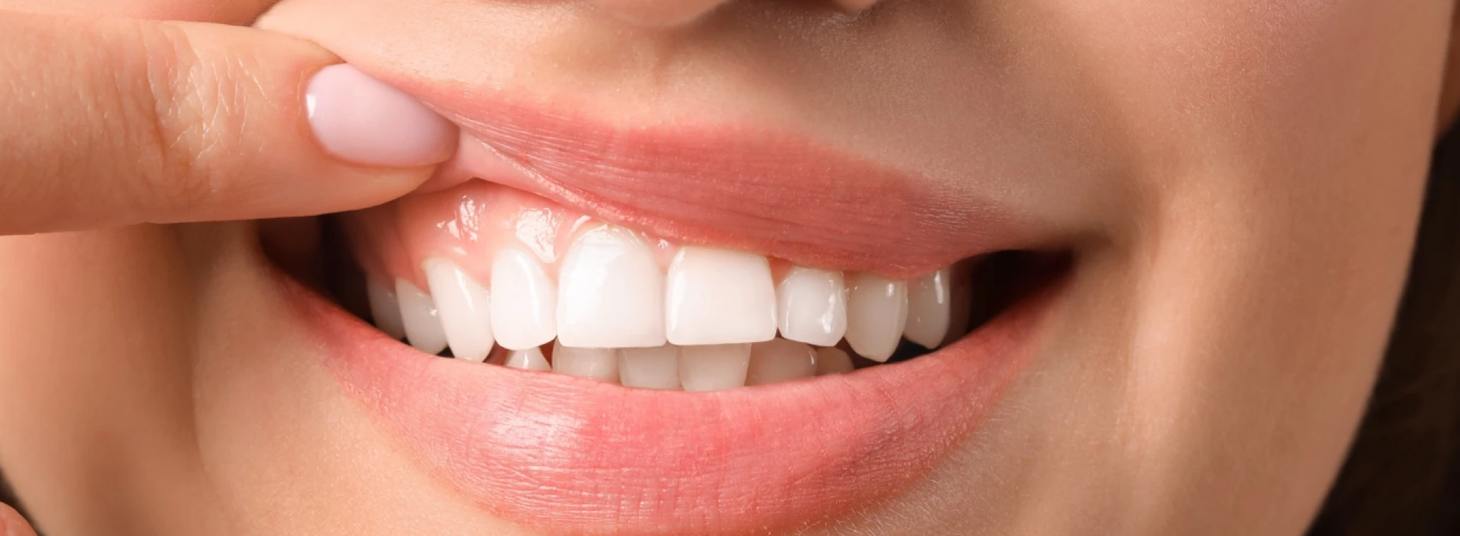 A detailed close-up of unhealthy white gums