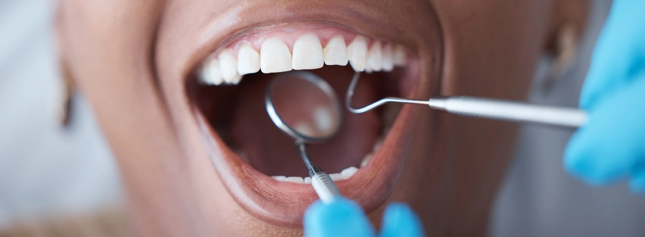 How Bad Breath Works | Crest