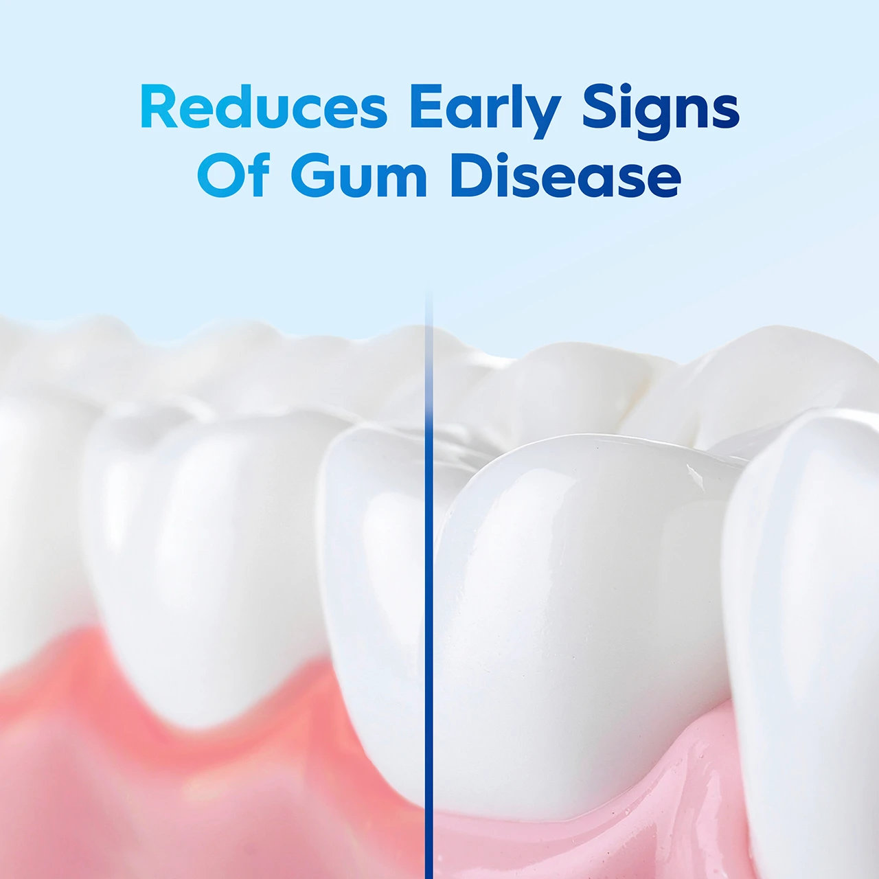 Reduces early signs of gum disease
