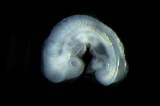 Image of Mouse Embryo