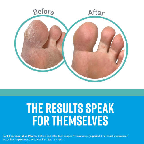 Healthy Feet Foot Mask Before After Infographic