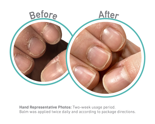 WH Cuticle Before After Lockup