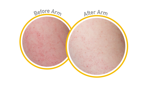 Skin Repair - Before and After Use - Guaranteed Relief for Extremely Dry, Itchy Skin
