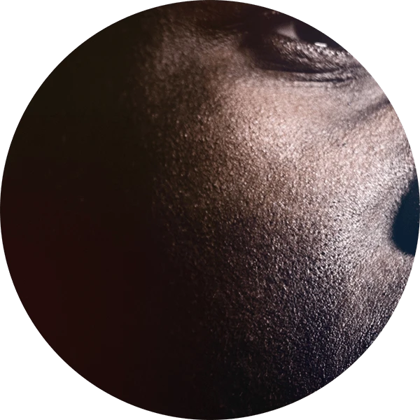Take on race