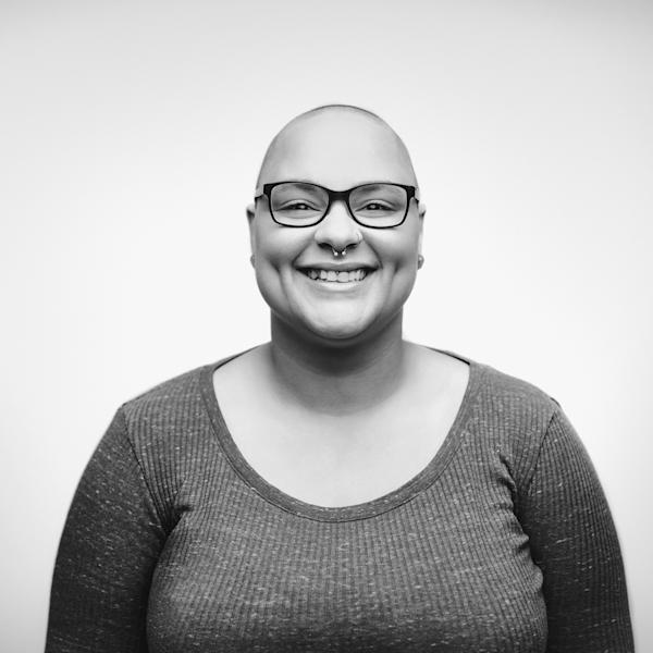 Alopecia Hero Image Alopecia Hero Image
