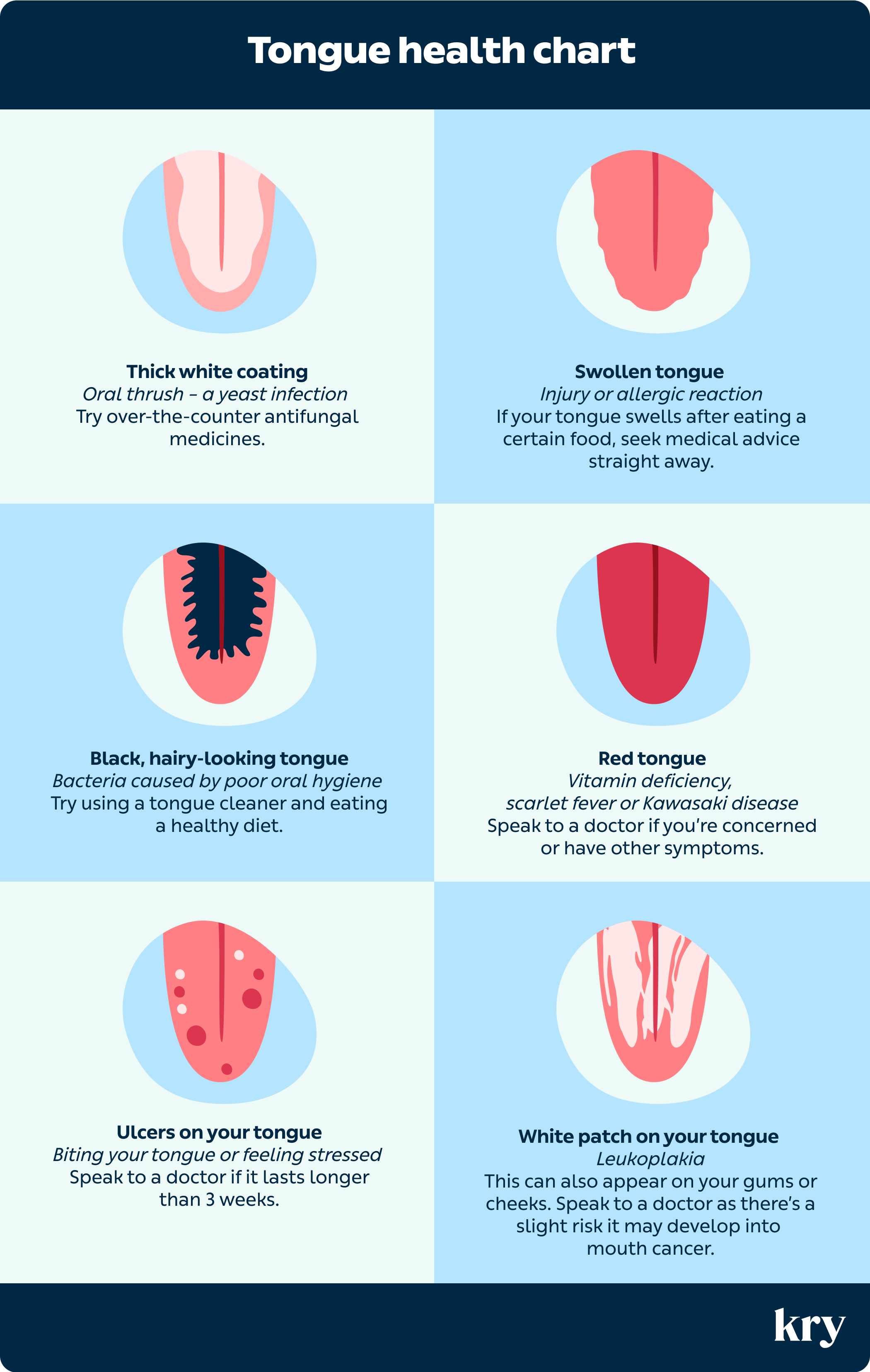 Tongue chart UK