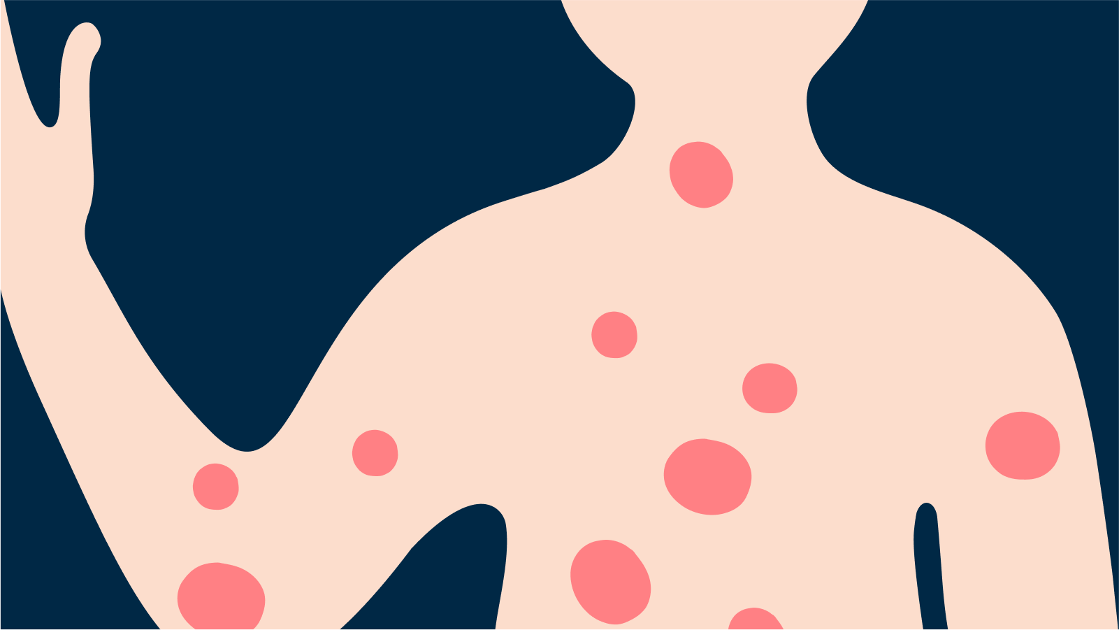 Eczéma chez l'enfant