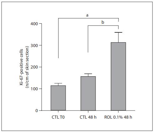 ROL-induced increase in the number of epidermal proliferating cells in human skin explants. ROL at a concentration of
0.1% was applied onto skin explants for 48 h. Epidermal proliferating cells were visualized by immunohistochemical staining of
Ki-67 protein, after 48 h of application. Positive cells were counted (3 counts/explant). Data are expressed as the mean number 8
SEM (n = 3 counts) of positive cells per centimeter of skin section.
a
p ! 0.01 versus untreated control at T0; b p ! 0.05 versus untreated control at 48 h. CTL = Control.