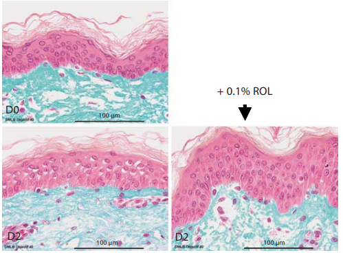 ROL-induced increase in epidermal thickness ex vivo in
human skin explants. ROL at a concentration of 0.1% was applied
onto skin explants for 48 h. Skin histology was visualized on day
0 (D0) and day 2 (48 h of incubation, D2) after Masson trichrome
staining of the explants.