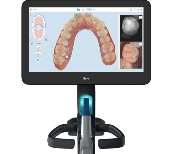 My Itero Doctor Site