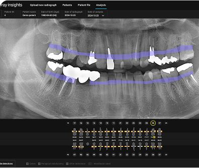 Enhanced diagnostics with detailed features.