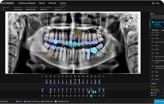 Standardized analysis of radiographs