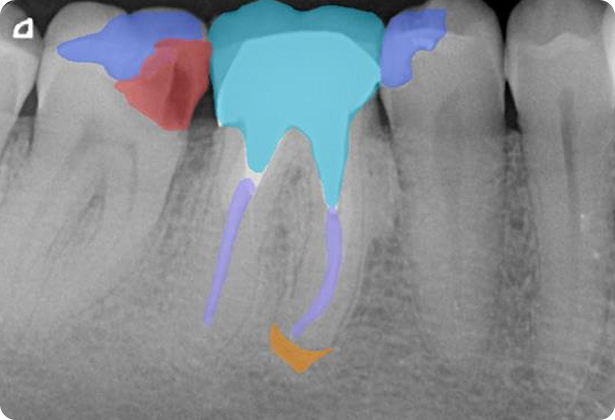 Your vision, enhanced