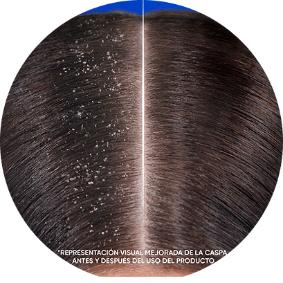 Antes y después de usar el nuevo h&s