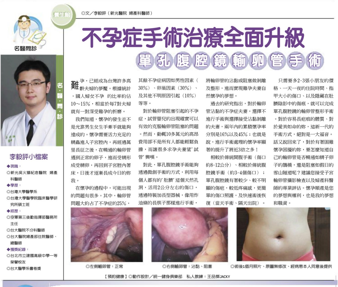 【工商時報】名.醫.問.診-不孕症手術治療全面升級