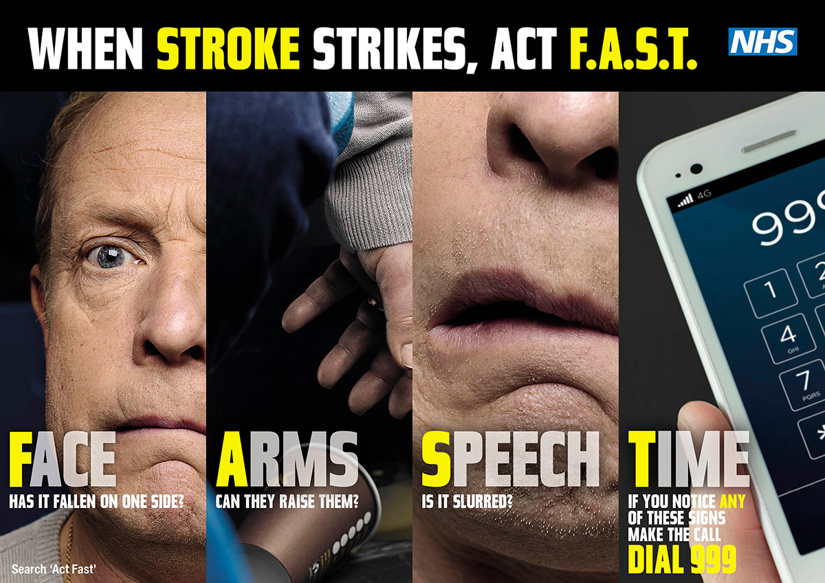 Think F.A.S.T - know the signs of stroke