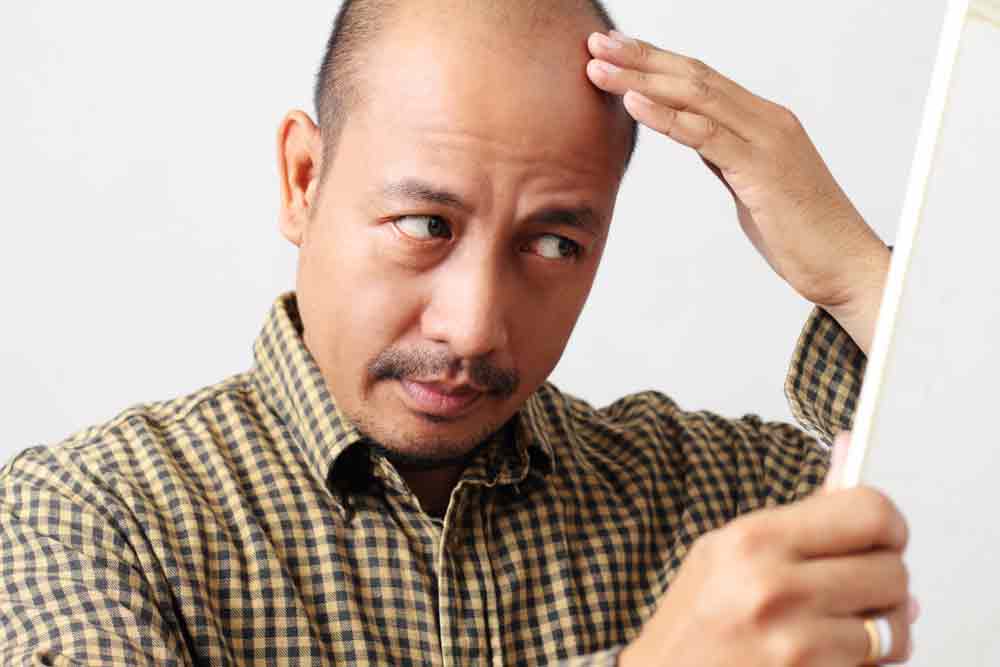 How to stop hair fall for men Image title: Hair loss in Men