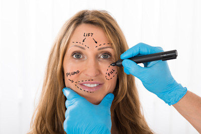 DE image 2 for Facelift Cost Guide
