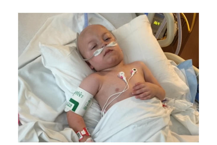 Caleb-at-week-4-5-following-diagnosis.