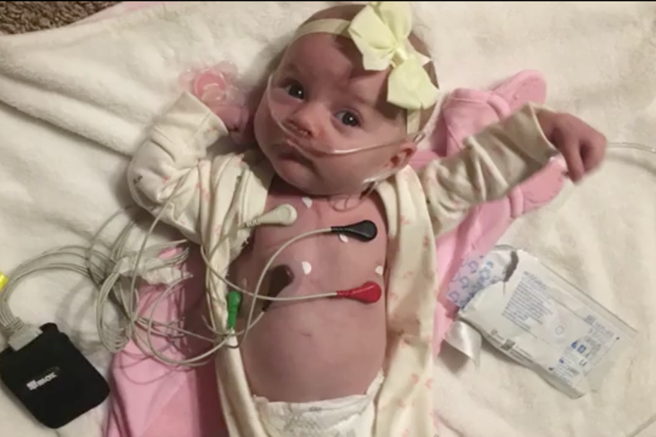 Everly as a baby in the hospital