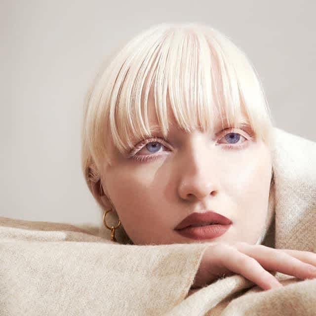 Violet eyes Natasya Kumarova albinism albino