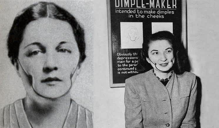 Woman wearing Isabelle Gilbert-s Dimple Maker invention