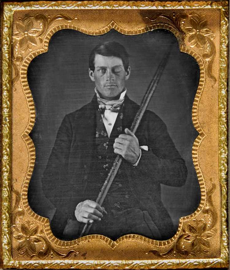 Phineas Gage railroad worker