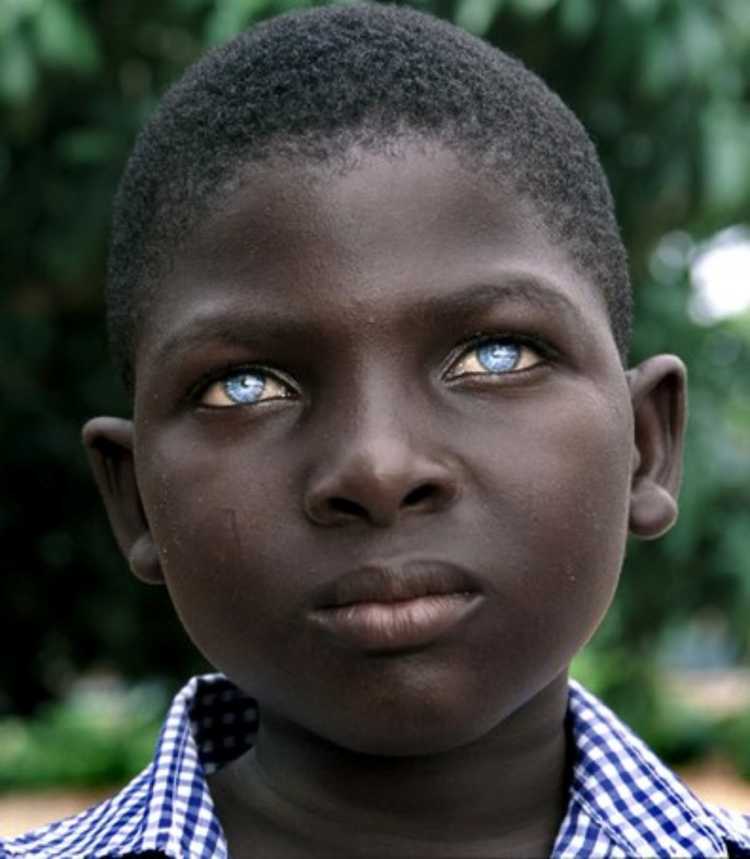 African boy Ice Blue eye colour