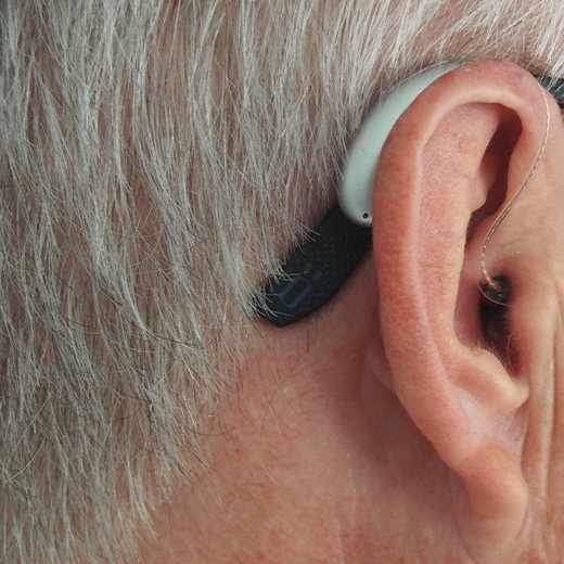 Nano Hearing Aids