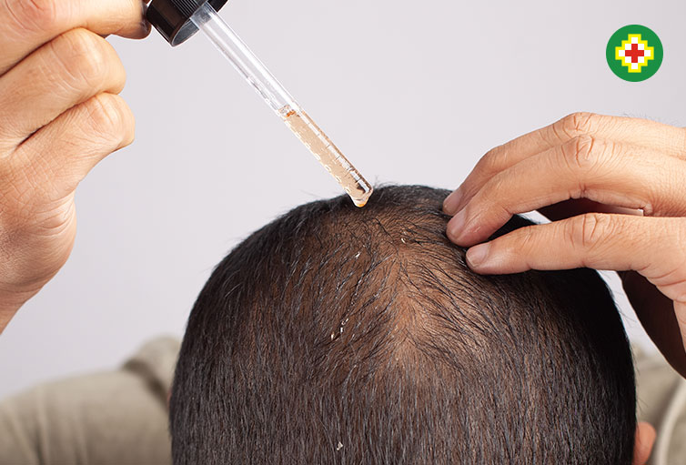 minoxidil 2