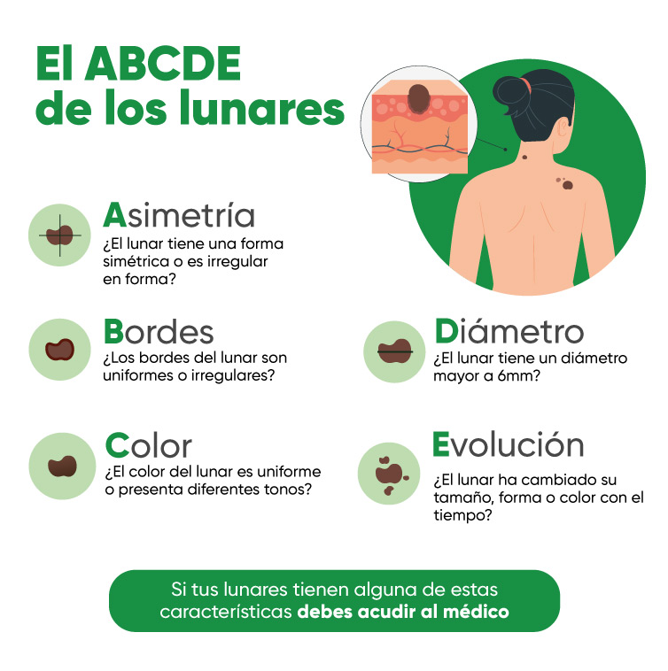 lunares-inkafarma-infografia