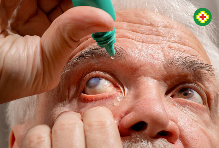 glaucoma