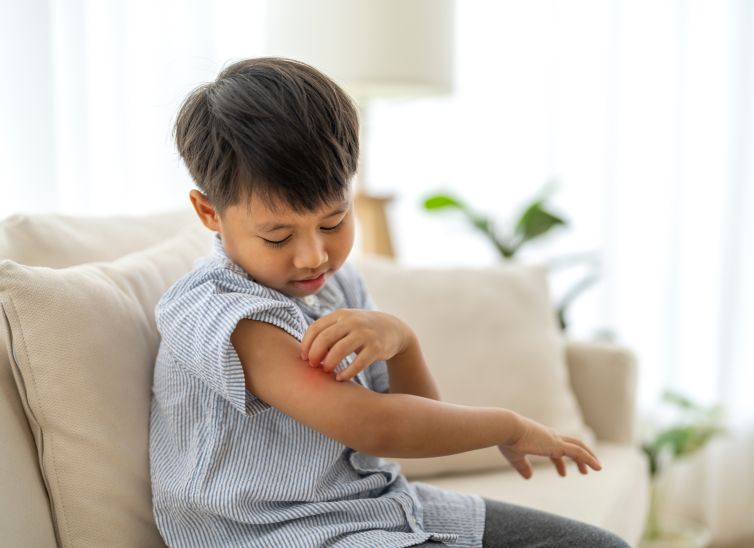 alergías en niños