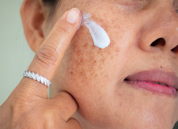 rostro-Hiperpigmentacion-Eucerin-inkafarma-banner-body