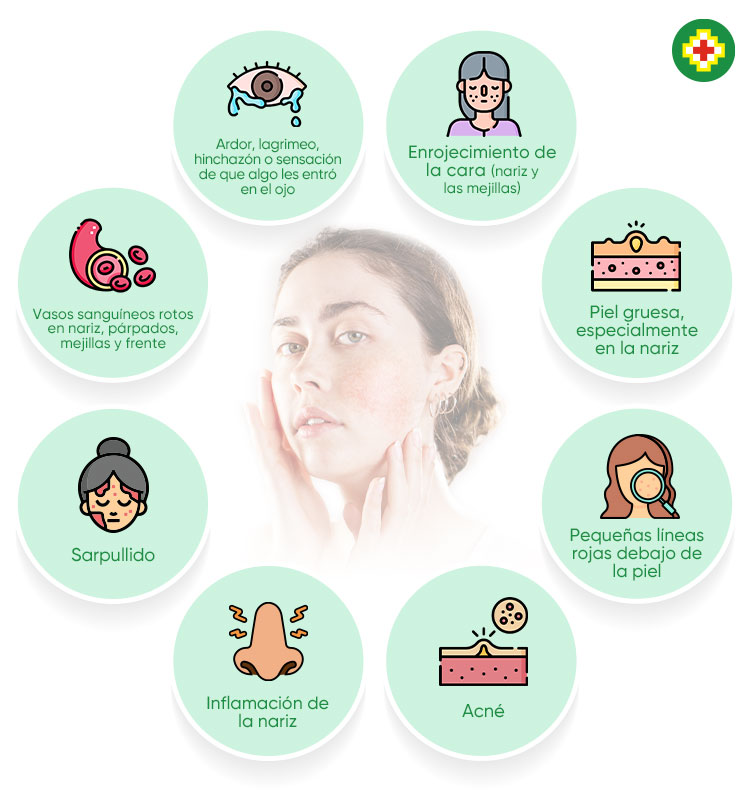 sintomas rosacea