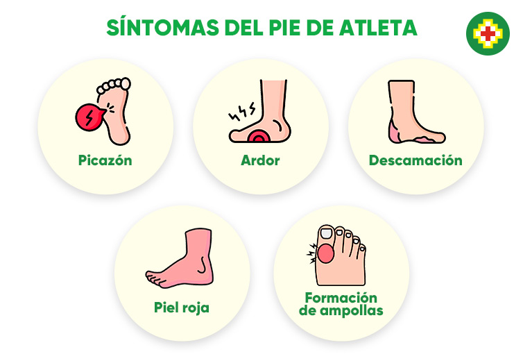 pie de atleta sntomas