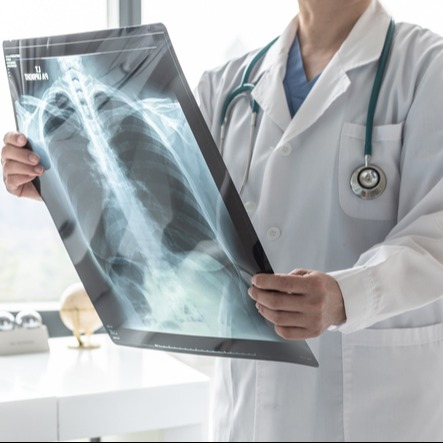 Doctor with radiological chest x-ray film