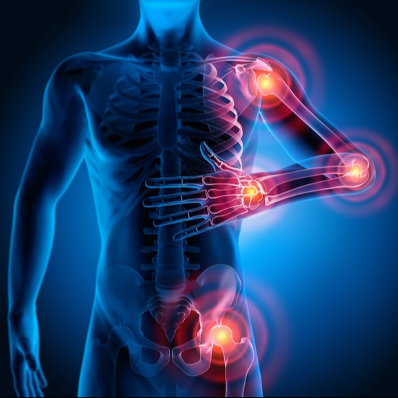 Full-Body Joint Pain – Inflammation Concept